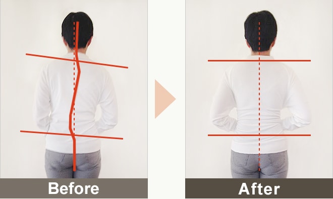 BEFORE&AFTERの写真