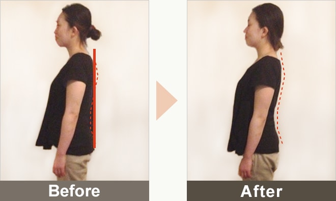 BEFORE&AFTERの写真