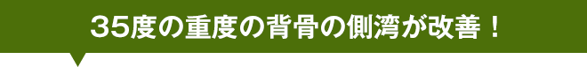 35度の重度の背骨の側湾が改善！
