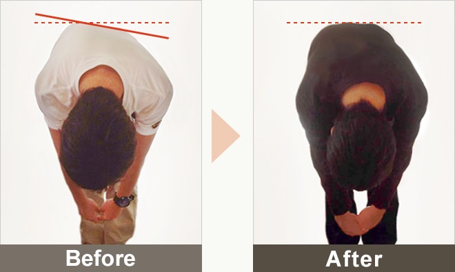 BEFORE&AFTERの写真