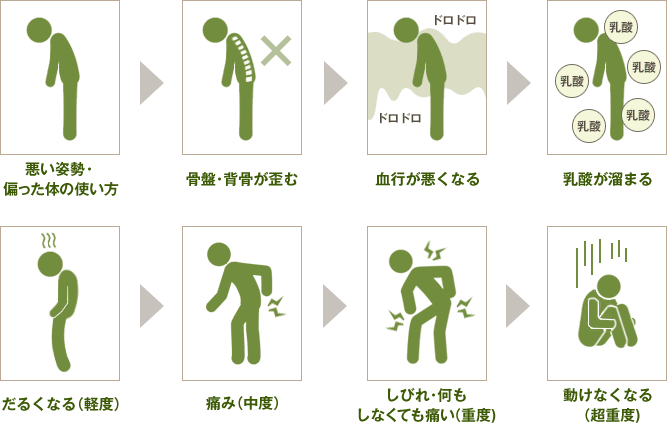 痛みのメカニズムのイラスト