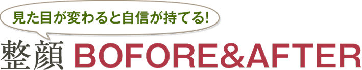 見た目が変わると自信が持てる！ 整顔 BOFORE&AFTER