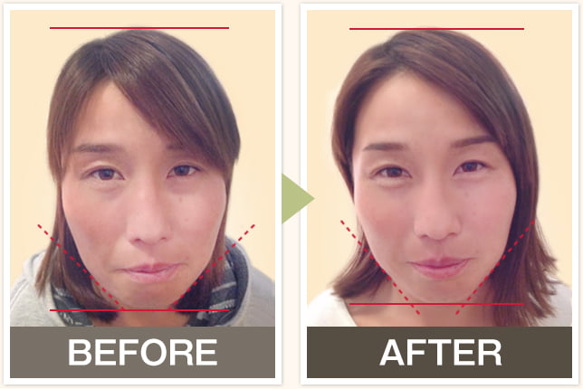 BEFORE&AFTERの写真