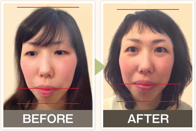 BEFORE&AFTERの写真