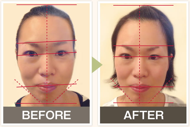 BEFORE&AFTERの写真