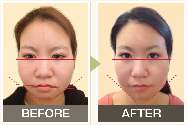 BEFORE&AFTERの写真