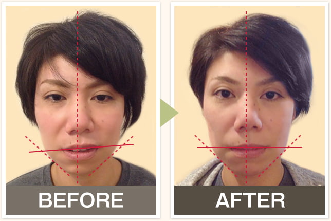 BEFORE&AFTERの写真