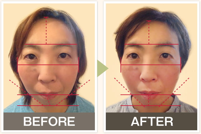 BEFORE&AFTERの写真