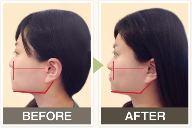 BEFORE&AFTERの写真